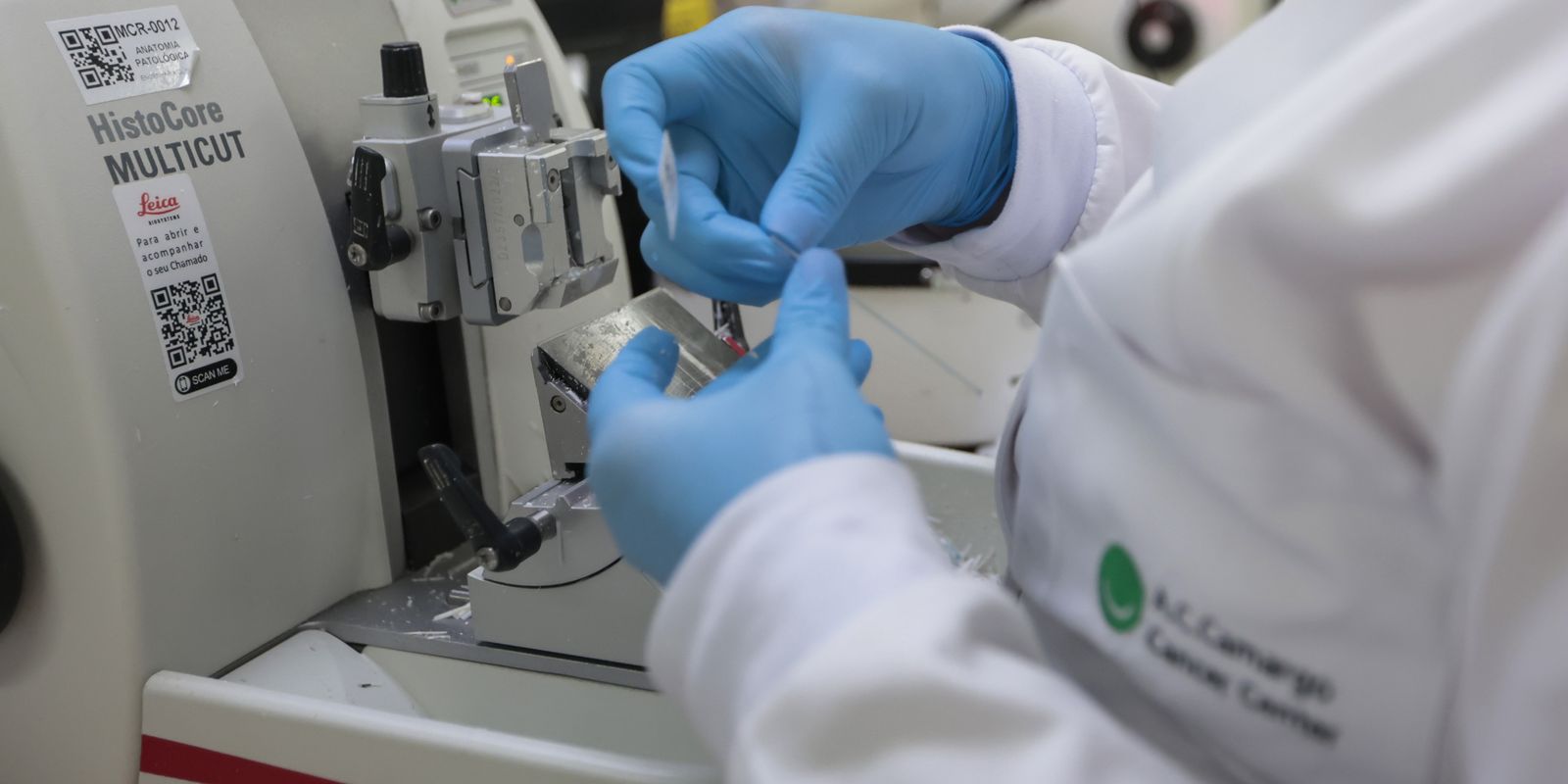 SUS inclui nova terapia para pacientes adultos com leucemia mieloide