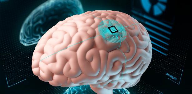 China aprova dispositivo médico colocado diretamente no cérebro